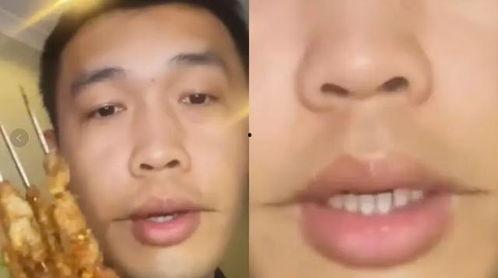 吃蜜瓜烧嘴唇,夏日甜蜜诱惑的意外“副作用”